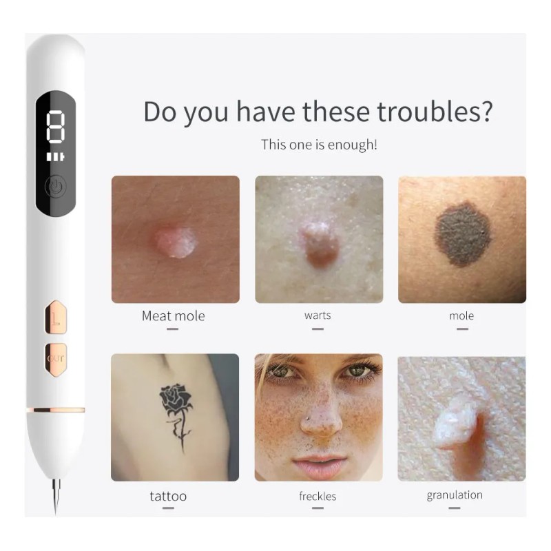 Cauterizer De Verrugas Pecas Lunares, Plumón Quita Verrugas
