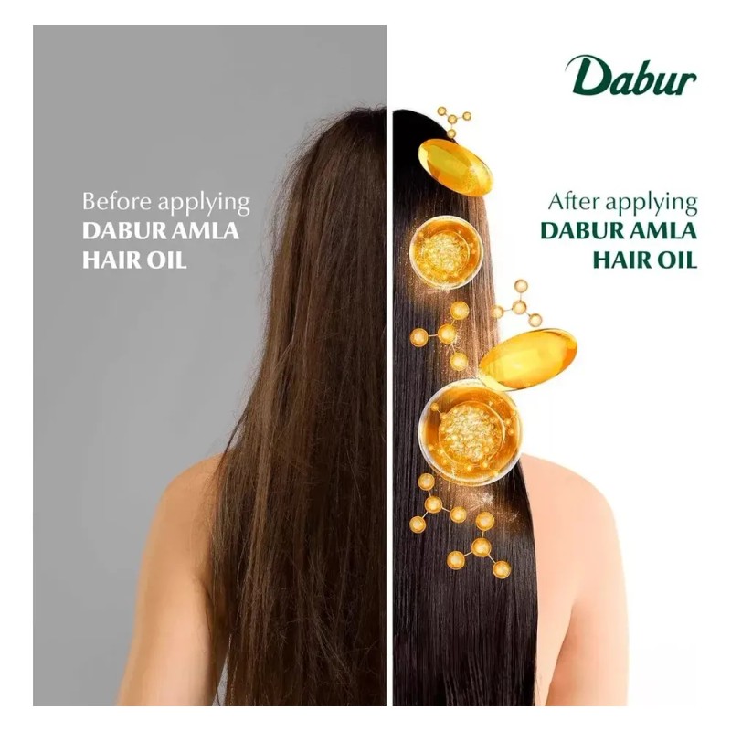 Dabur Aceite De Amla Para Cabello 300ml Aceite Nutritivo