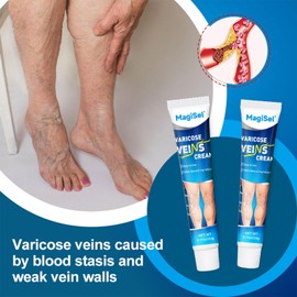 Varicose Veins Cream, Cream Against Spider Veins, Varicose Veins Cream, Ointment Vein Cream, 20 g Ointment Against Spider Veins, Leg Care Cream for Heavy & Tired Legs, Refreshment & Relaxation