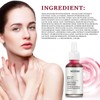 AHA 30% + BHA 2% Peeling Solutions, Glycolic Acid Peel