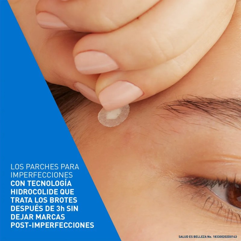 Cerave Parches Control Imperfeccion 22p Piel Tendencia Acné
