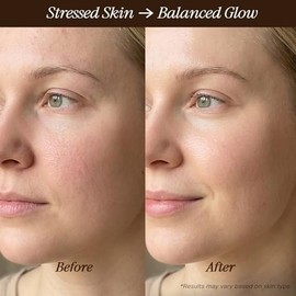 Aceite facial orgánico USDA, fabricado en Estados Unidos con ingredientes naturales, fórmula antienvejecimiento para pieles propensas al acné y grasas