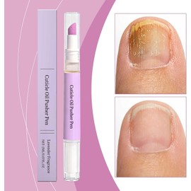 Lápiz de aceite para cutículas con empujador de cutículas de cerámica, lápiz para el cuidado de las uñas para remover padrastros y reparar cutículas, lápices aceites removedores cutículas suave (2PC)