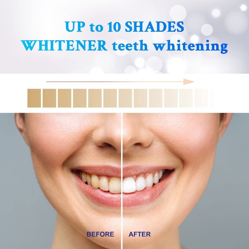 Waving Palms Teeth Whitening Strips, Whitening Strips, 28 Non-Sensitive Whitening