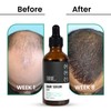 ThriveCo Hair Growth Serum | with Rosemary Redensyl, Anagain, Procapil