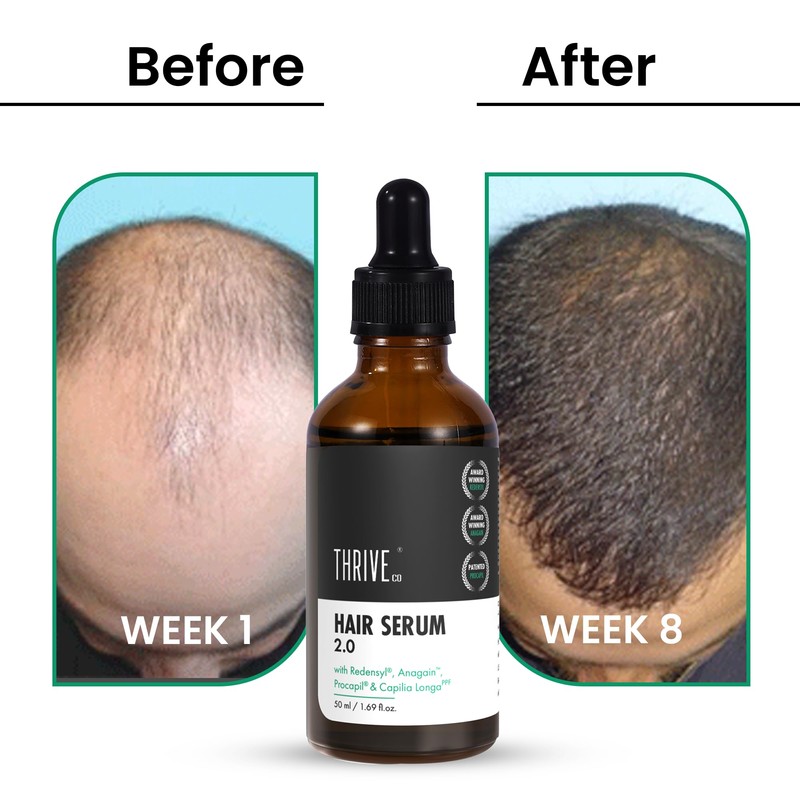 ThriveCo Hair Growth Serum | with Rosemary Redensyl, Anagain, Procapil