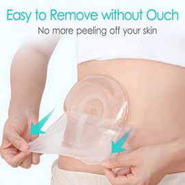 8" x 8" Ostomy Shower Cover [Pack of 25], Ostomy Bag Shower Protector Stoma Shower Guard Colostomy Shower Shields Waterproof Bandage for Women Men Showering