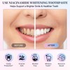 Niacinamide Whitening Toothpaste, Radiant Whitening Toothpaste, Stain Removal Natural, Complete