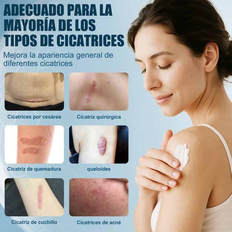 Crema Para Cicatrices, Elimina Cicatrices Y Quemaduras 20g