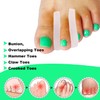 Reppkyh 20 Stück Gel-Zehenspreizer für Ballenzehen, Silikon-Zehenspreizer, Ballenzeh-Korrektor für Füße,