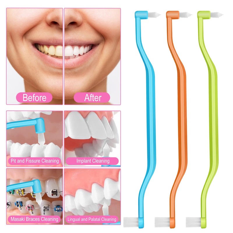 6 Pcs Soft Interdental Brushes Small-Head Orthodontic Toothbrush Teeth Detail