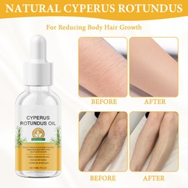 Pack of 2 Cyperus Rotundus Oil, Cyperus Oil for Hair Removal, Natural Cyperus Rotundus Oil for Hair Removal, Reduce Body Hair Growth, for Skin Care, Relaxation and Conditioning (30 ml)