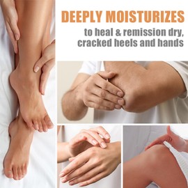 Honey Foot Cream - Foot Cream For Cracked Heels And Dry Skin - Deep Hydration Foot Moisturiser - Intensive Moisturizing Foot Care Stick - Daily Skin Care Hands & Feet Anti-Dry And Anti-Crack