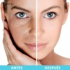 3pc Crema Hidratante Humectante Facial Hydroboost 100g Normal Noche