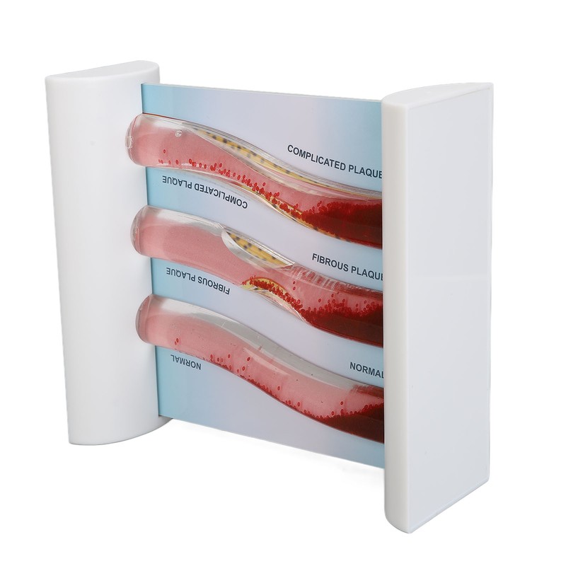 Lipoprotein LDL Blood Vessel Model Low Density Blood Lipid Vessel