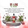 Rose Molly Rose Molly 10-in-1 Chebe Oil for Hair Growth,