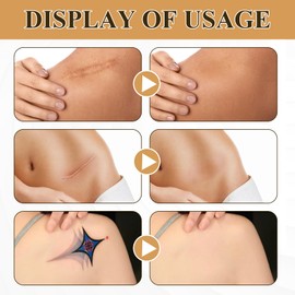 Pack of 12 Tattoo Covers Tattoo Cover Tattoo Plaster Tattoo Cover Waterproof