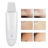 Household Ultrasonic Skin Scrubber Blackhead Removal Face Pore Cleanser InstrumentWhite