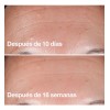 Biotiks Sérum Facial De Retinol, Niacinamida, Rosa Mosqueta Antiedad