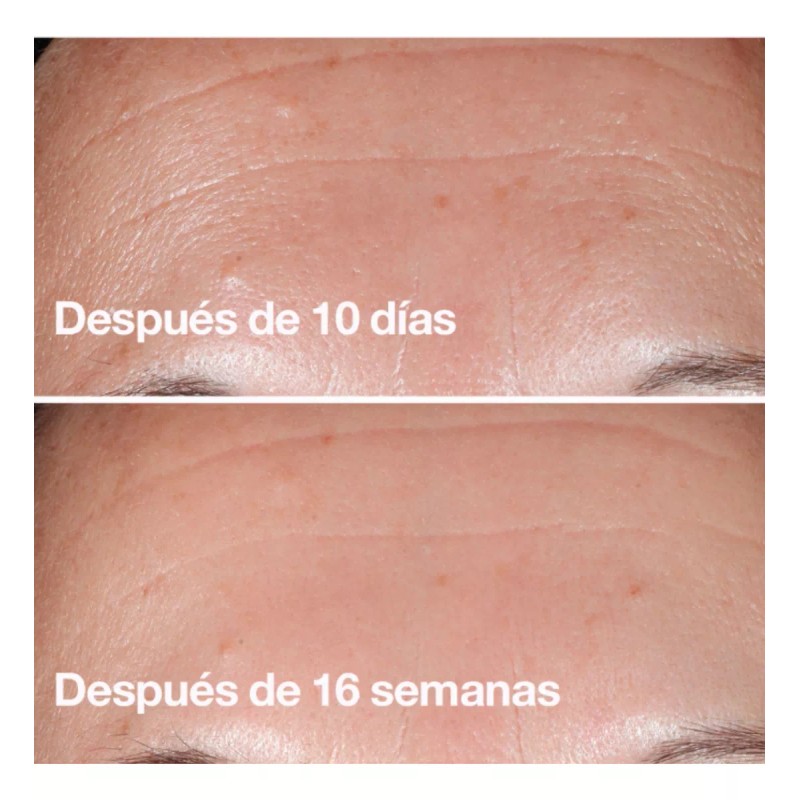 Biotiks Sérum Facial De Retinol, Niacinamida, Rosa Mosqueta Antiedad