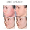 Mz . Facial Reafirmante Hidratante Activo Antiarrugas Fade