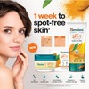 Himalaya Dark Spot Clearing Curcuma Face Wash, Boosts Skin Radiance