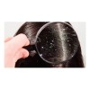 Shampoo Anticaspa Salerm Biokera 1lt