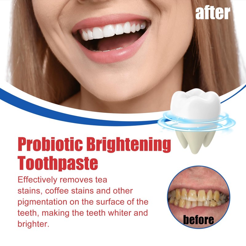 Mikabila (03) Pack of 2 Sp-6 Toothpaste, Ultra Whitening Toothpaste