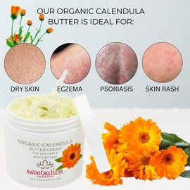 Sweetsation Therapy Organic Calendula Soothing Baby Butter Cream for Dry, Irritated Itchy Skin, Eczema, Psoriasis, soothing and healing 4oz. With Calendula, Avocado and Vitamin E.