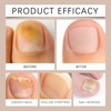 Aceite para cutículas de uñas con jojoba y vitamina E,