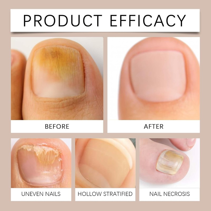 Aceite para cutículas de uñas con jojoba y vitamina E,
