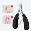 7pcs Ingrown Toenail Correction Tools Kit Stainless Steel Pedicure Foot