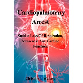 Cardiopulmonary arrest: unexpected loss of heart function, breathing and consciousness