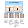 100ml Hair Removal Lotion Gentle Moisturizing Hair Remover Inhibitor for