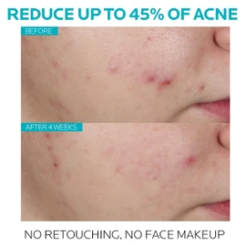 La Roche Posay Effaclar Serum 30 ml / 1.01 oz