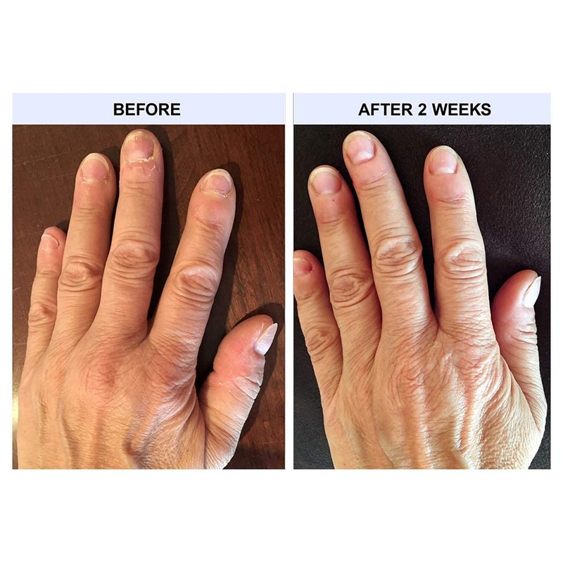 TIPS Nail Conditioner 3 Pack