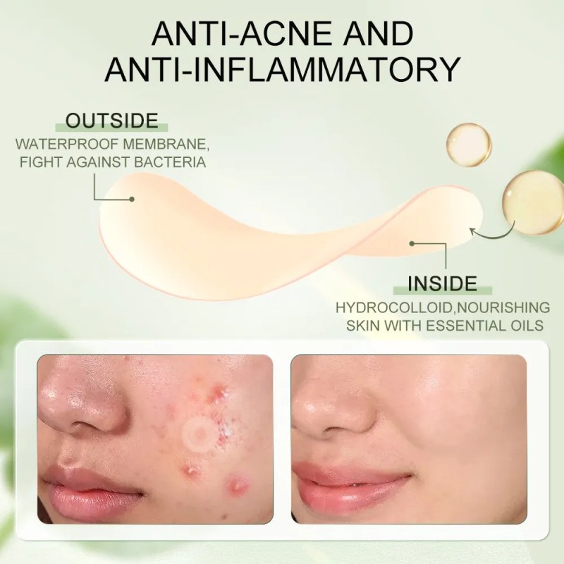 Sace Lady Parche Antiacné Hidrocoloide Para Rostro Aisla Todo Tipo