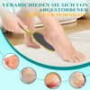 HovuuTuig Nano Glas Callus Remover, Gentle Foot Care with Long