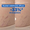 Mixa Olio Per Smagliature Nutriente, Adatto a Pelli Sensibili, Pelle