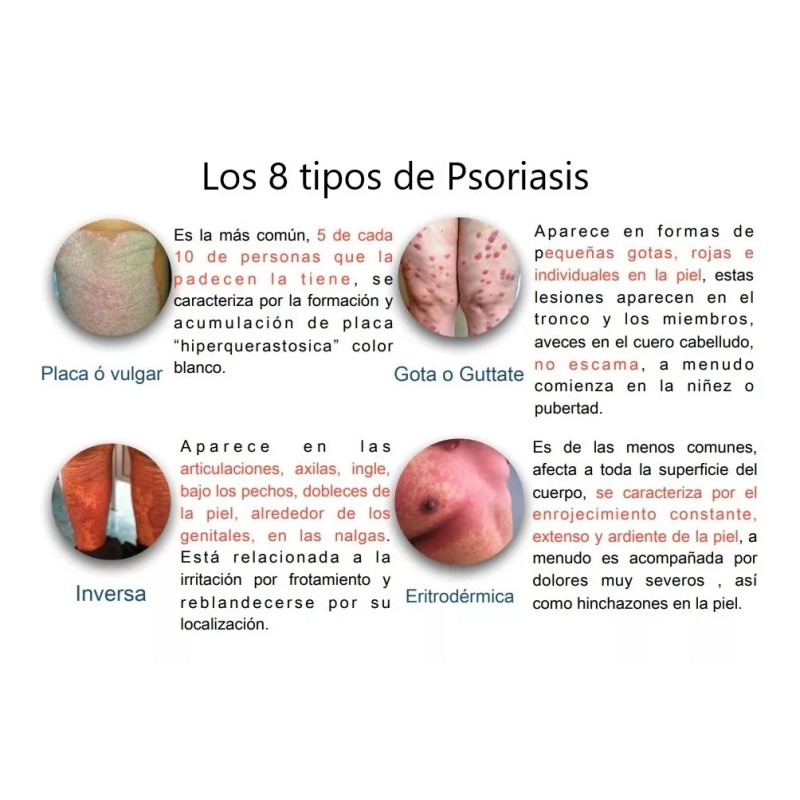 Nopsor 500gr Crema Mas Suave, Pomada Nopsor 125gr Aux. Tx