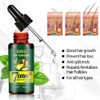 Lanthome Hair Growth Ginger Hair Nutrient Serum for Thinning Hair,