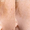 Veet Sensitive Precision™ Dermaplaning Face Kit
