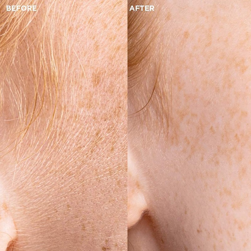 Veet Sensitive Precision™ Dermaplaning Face Kit