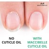 Aceite De Cutícula Para Uñas Tamaño De Recambio Para Cutículas