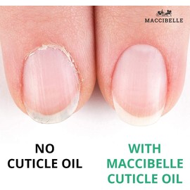 Aceite De Cutícula Para Uñas Tamaño De Recambio Para Cutículas Secas Agrietadas (16 Onzas, Piña)