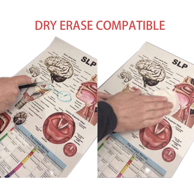 Hip and Knee Anatomical Poster, size 24Wx36T