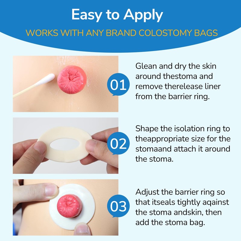 Heagimed 10Pcs 2mm Moldable Ostomy Rings, Hydrocolloid Stoma Barrier Rings