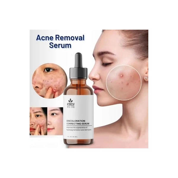 korean Alpha Arbutin Serum 5% 1oz - New