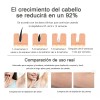 Tensky Depiladora Permanente Láser 999,999 Flashes Facial Y Corpora Niveles
