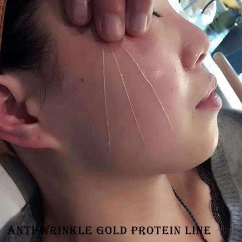 CeFurisy Collagen Silk Threads for Lifting Thread Lifting for Skin